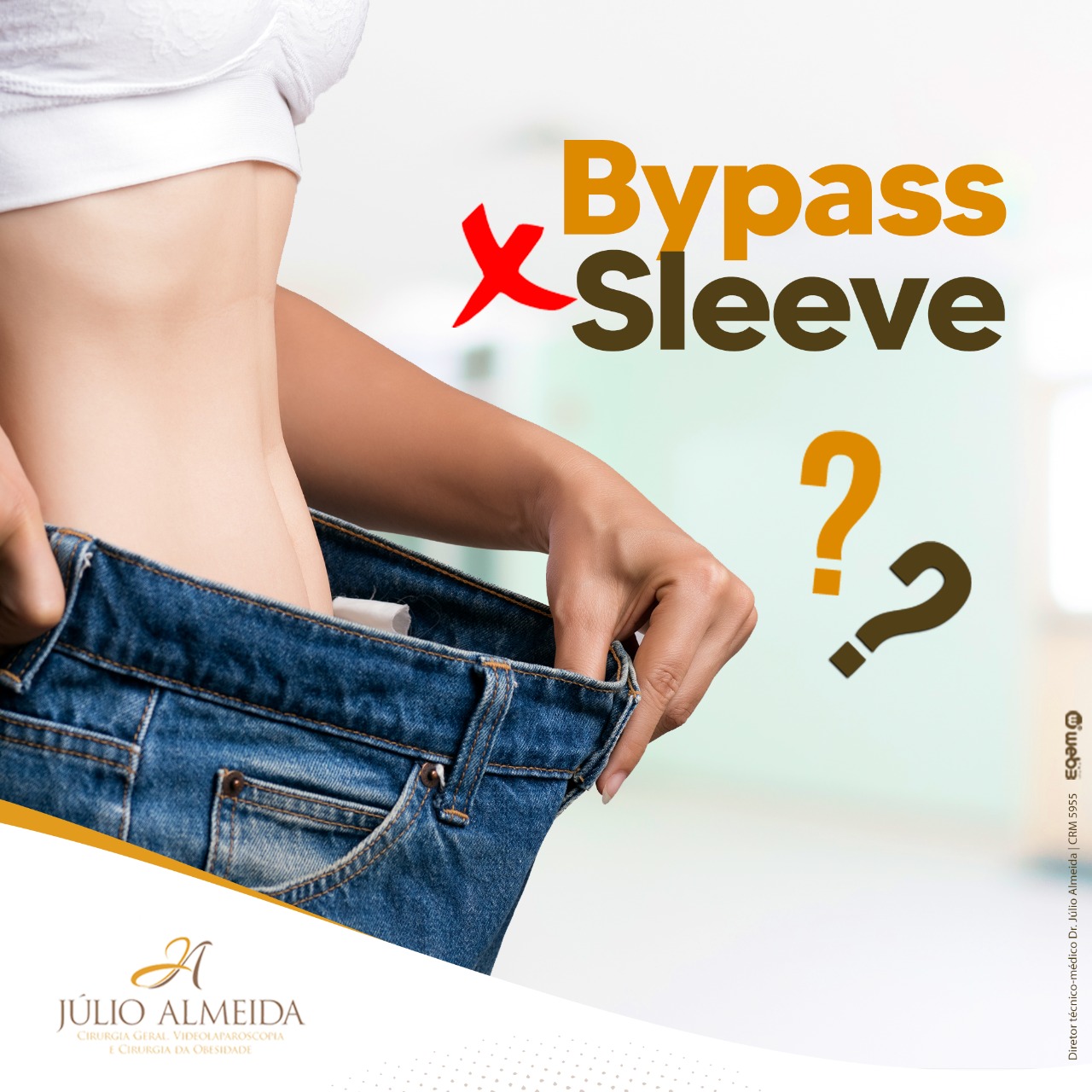 Dr Alexandre - Bypass vs Sleeve