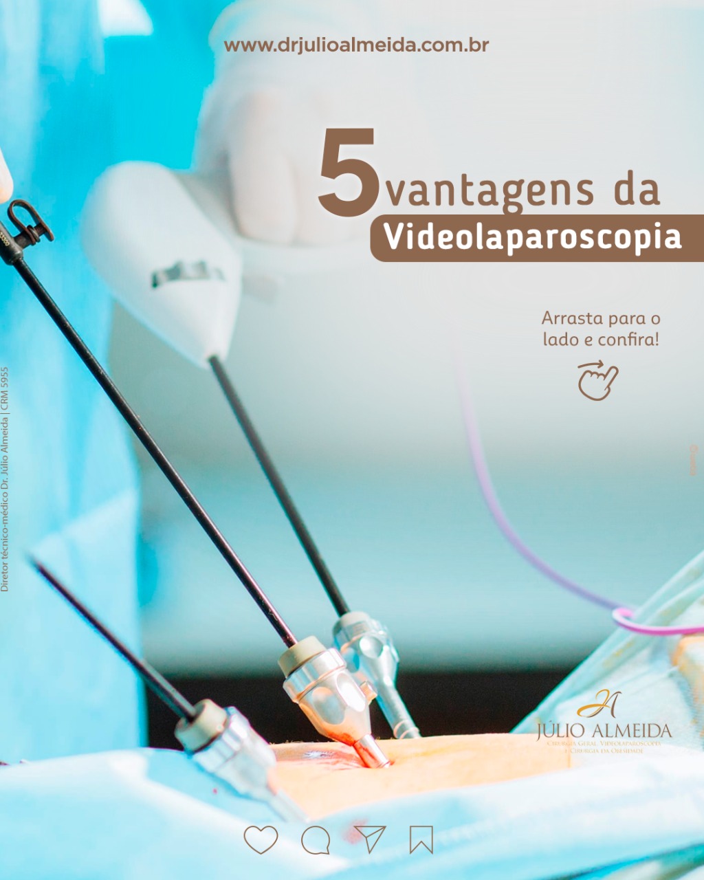 5 vantagens da Videolaparoscopia